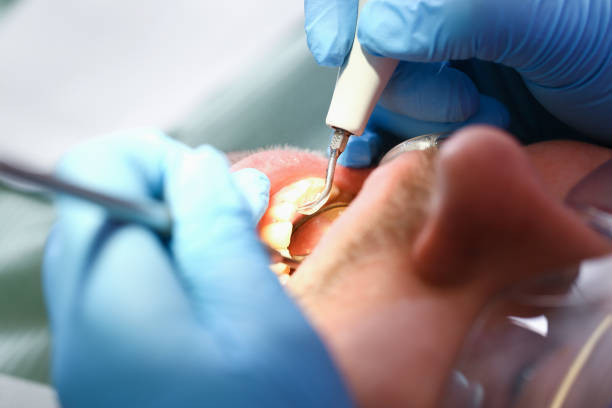Best Urgent Dental Care for Toothaches in Roma, TX